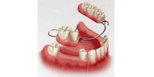 West LA Dental Care Heigiene