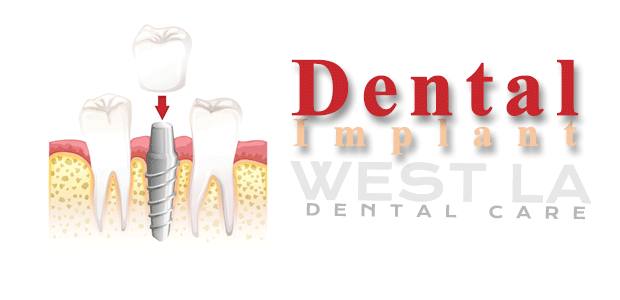 West LA Dental Care Oral Hygeine