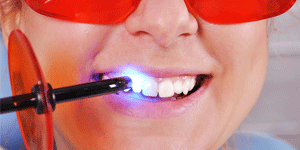 West LA Dental Care Heigiene