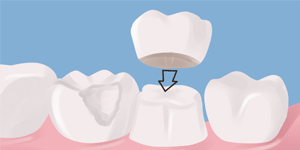 West LA Dental Care Heigiene