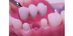 West LA Dental Care Heigiene