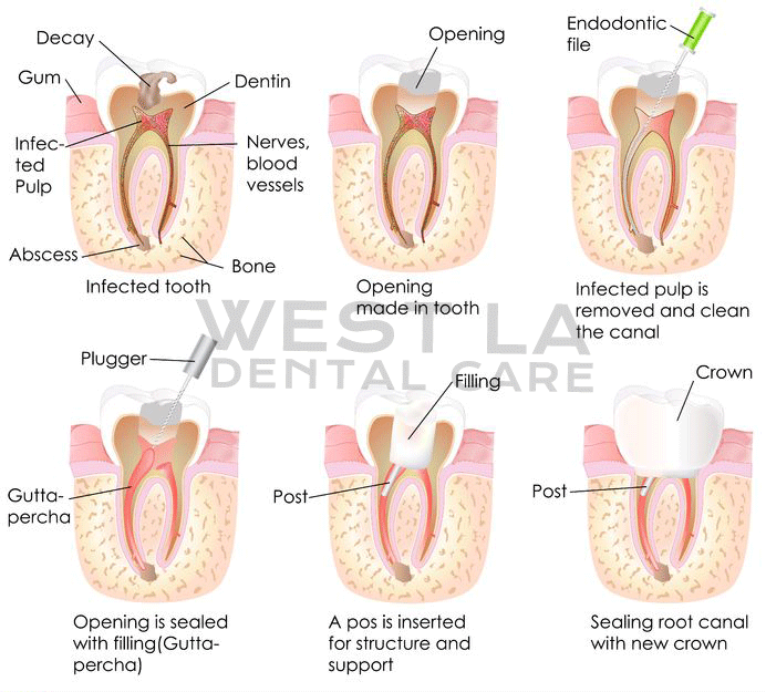 West LA Dental Care Heigiene